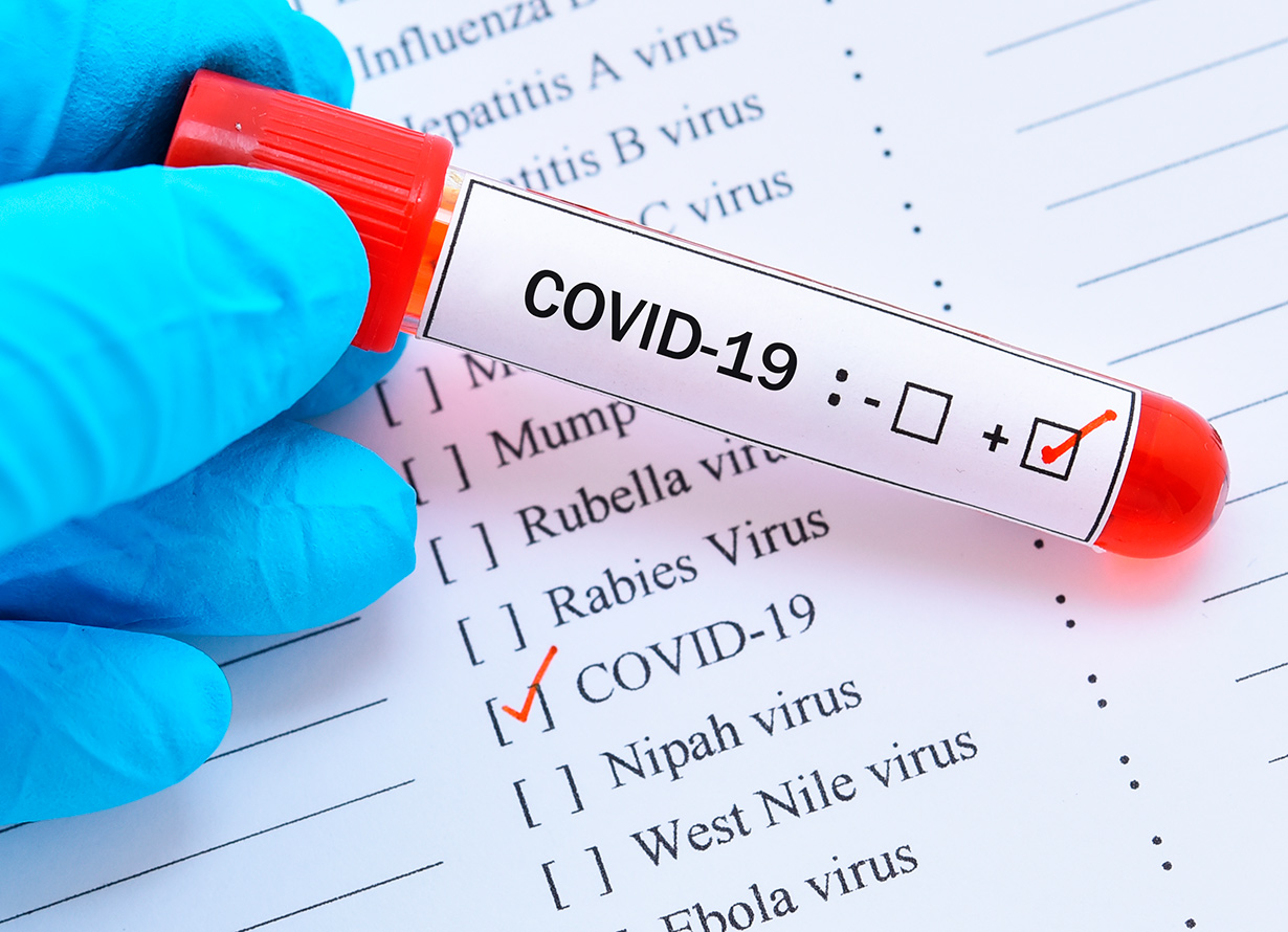 Foto em detalhe de mão segurando um tubo de ensaio com sangue dentro. Nele, há uma etiqueta com a escrita coronavirus e um tique no sinal de positivo. Ao fundo, há uma folha branca com diversas doenças listadas